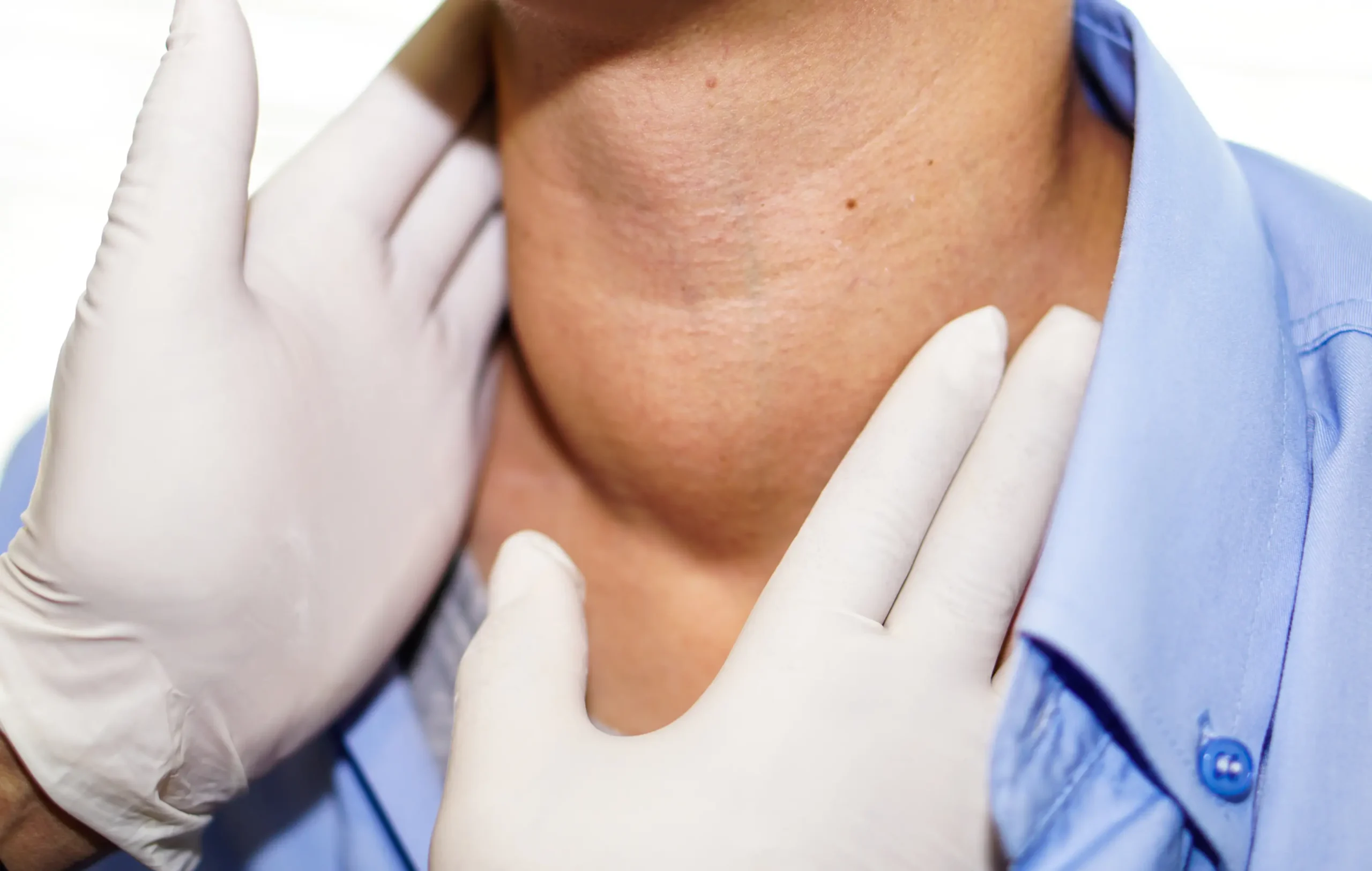 Clinical examination of thyroid gland and neck swelling