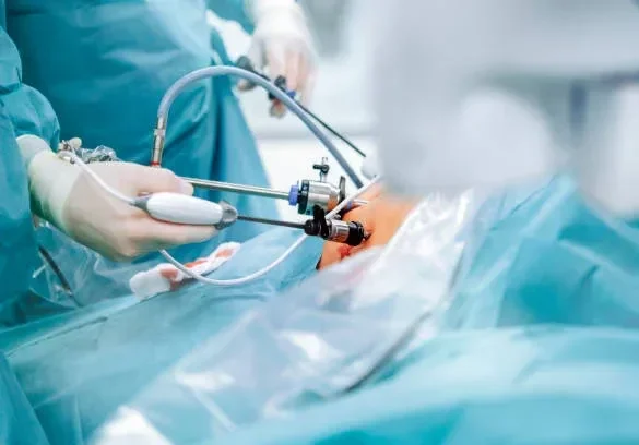 Laparoscopic Surgery in Lahore