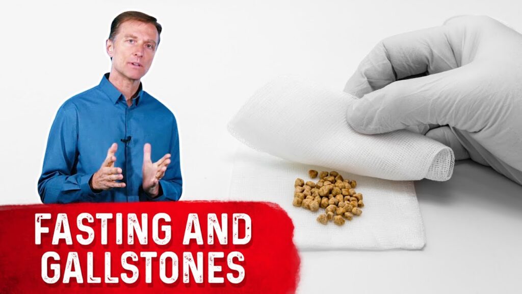 Fasting and gallstones explained by Prof. Dr. Zahid, laparoscopic surgeon in Lahore