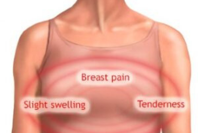 Breast pain, tenderness and swelling symptoms explained by specialist in Lahore