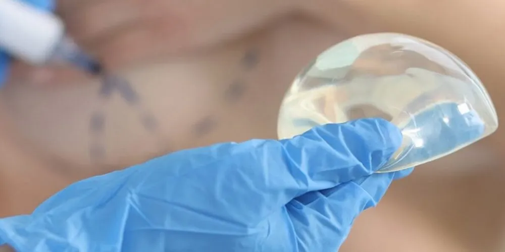 Silicone breast implant held during pre-surgical consultation