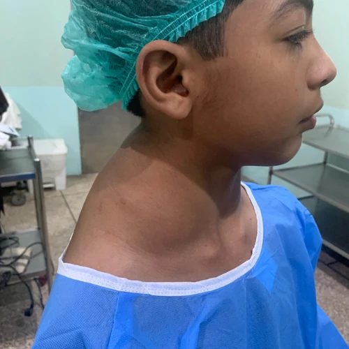 Neck swelling evaluation and surgical treatment in Lahore