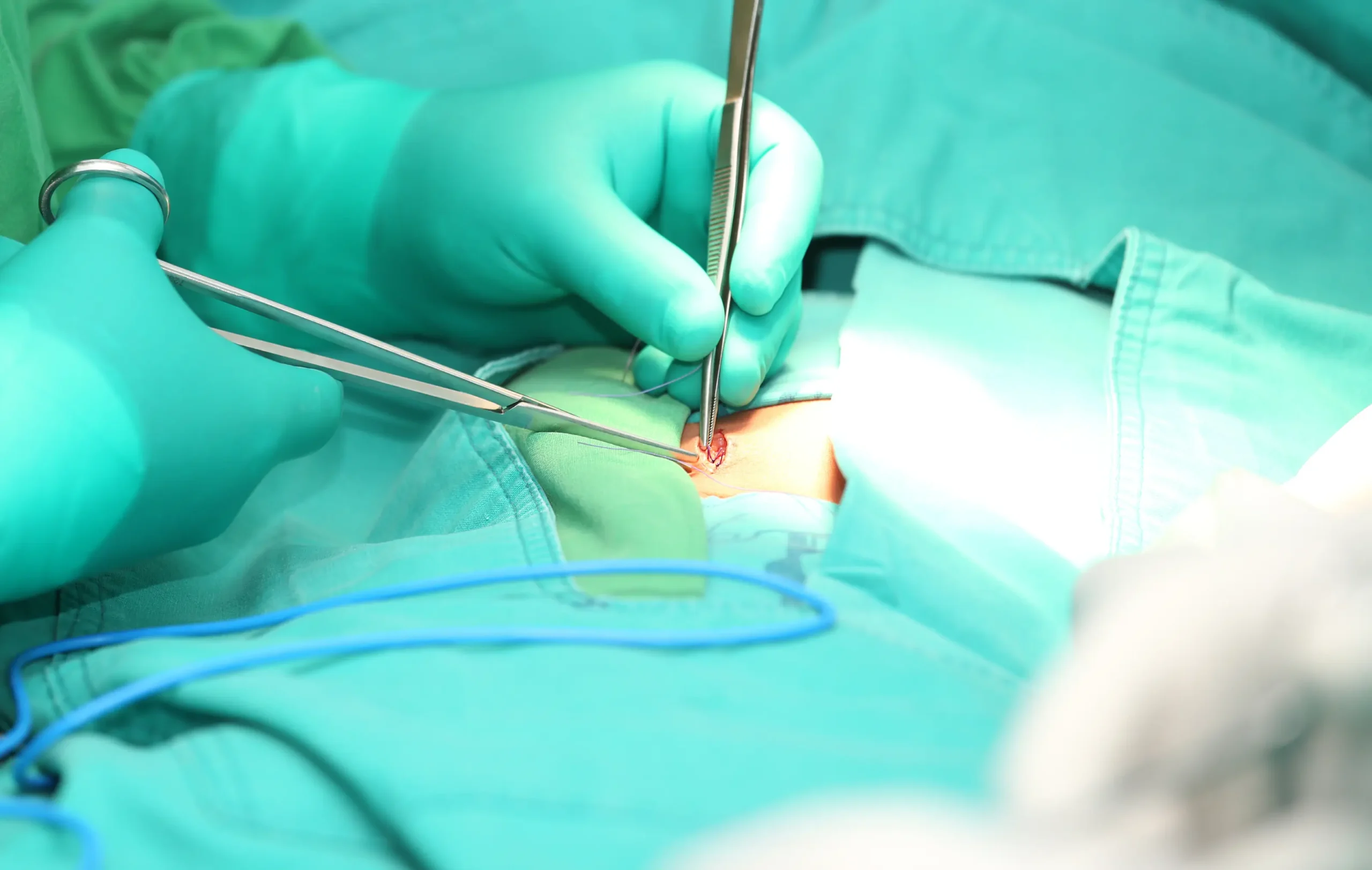Minor surgical procedure with suturing under sterile conditions