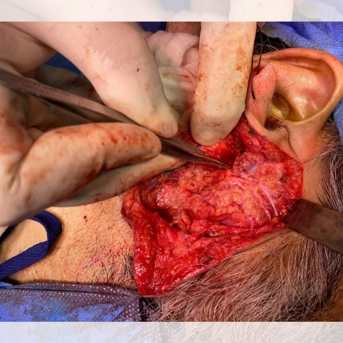 Prof Zahid Mahmood General Surgeon In Lahore