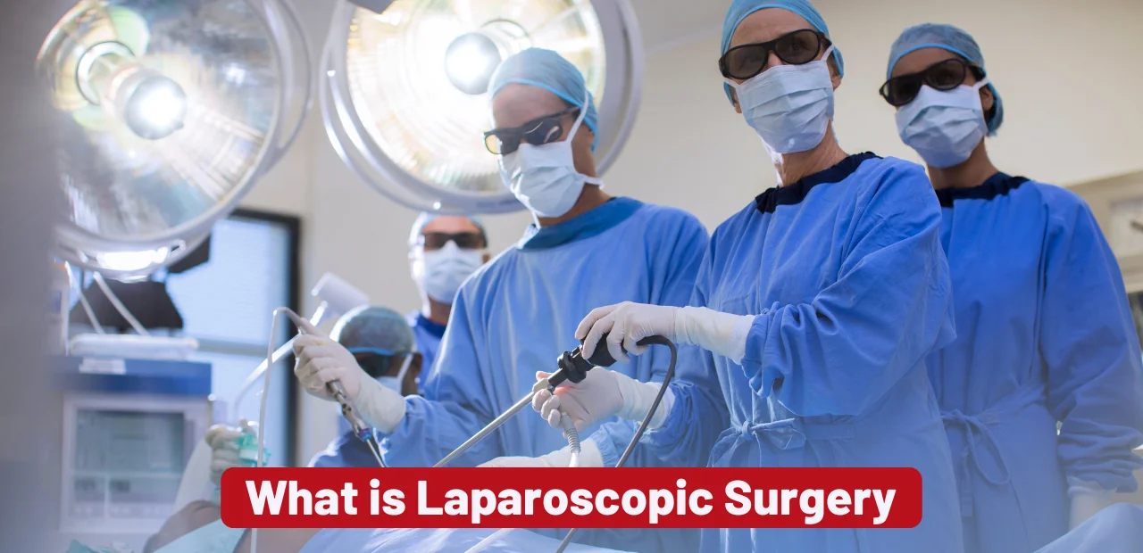 What is Laparoscopic Surgery