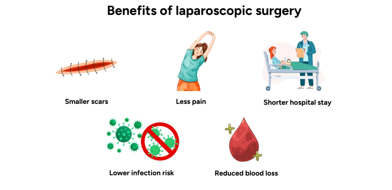 Benefits and Risks of Laparoscopic Surgery 1 Benefits and Risks of Laparoscopic Surgery